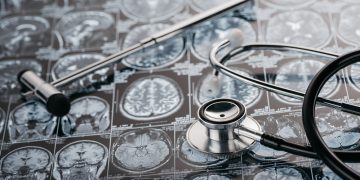 Verständnis der Ursachen von venösen Angriffen der Hirnarterie – Oren Zarif