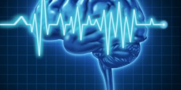 Verständnis der Ursachen von venösen Angriffen der Hirnarterie – Oren Zarif